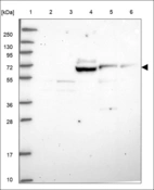 Anti-TCAIM Antibody