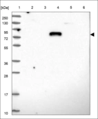 Anti-LTK Antibody