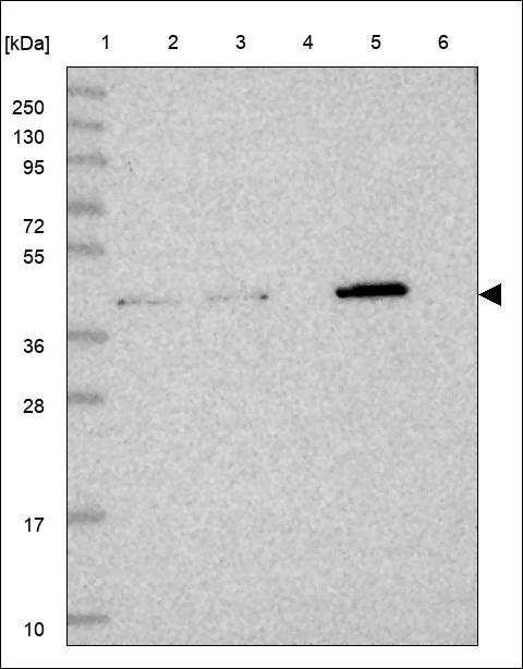 Anti-ZDHHC11 Antibody