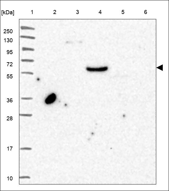 Anti-RBMY1A1 Antibody