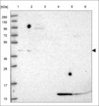 Anti-SERPINE1 Antibody