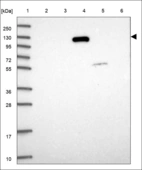 Anti-TRAPPC10 Antibody