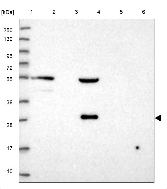 Anti-RTBDN Antibody