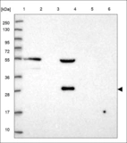 Anti-RTBDN Antibody