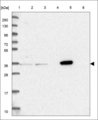 Anti-HMG20B Antibody