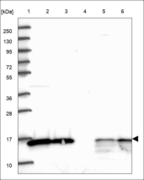 Anti-SRP14 Antibody