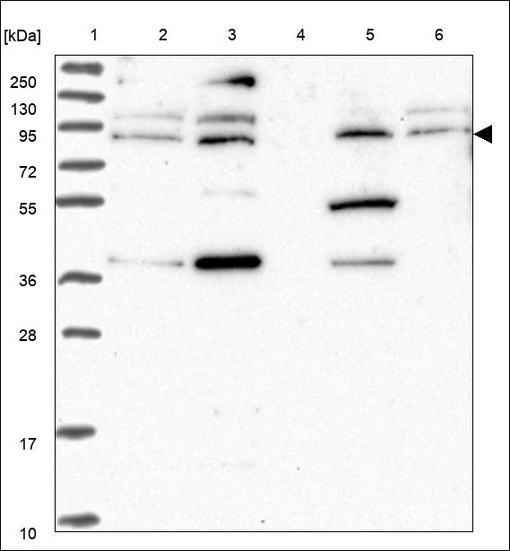 Anti-RNF103 Antibody