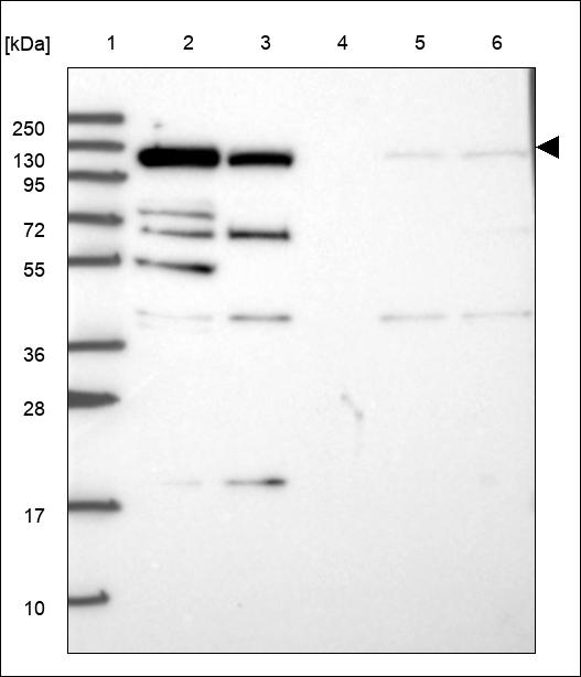 Anti-NEDD4 Antibody