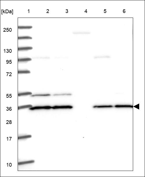 Anti-PGAM1 Antibody