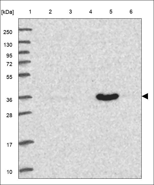 Anti-AKR7A2 Antibody