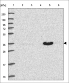 Anti-AKR7A2 Antibody