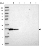 Anti-RND3 Antibody