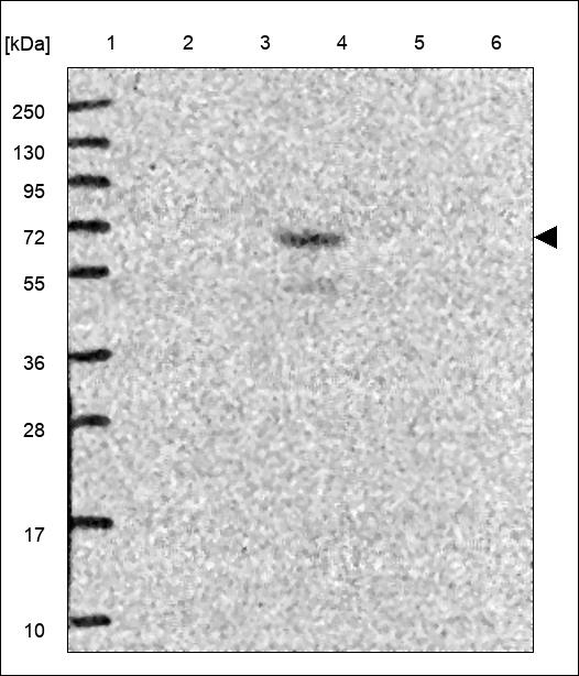 Anti-ADGRE3 Antibody