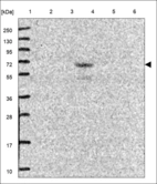 Anti-ADGRE3 Antibody