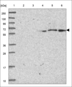 Anti-CEP76 Antibody