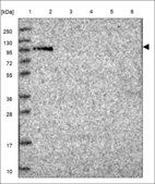 Anti-VPS39 Antibody