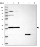 Anti-KNSTRN Antibody