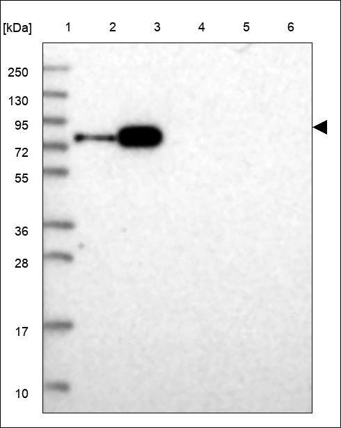 Anti-POLK Antibody