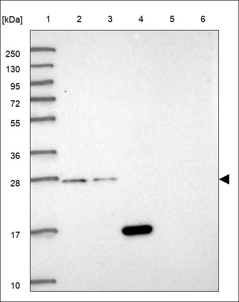 Anti-PDCD10 Antibody