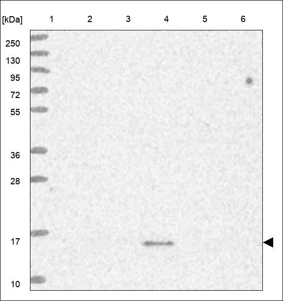 Anti-RAB22A Antibody