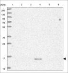Anti-RAB22A Antibody