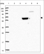 Anti-TPCN2 Antibody