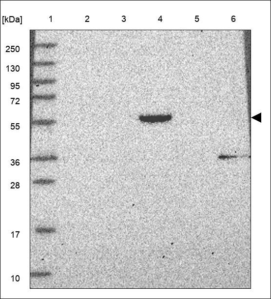 Anti-CHST15 Antibody