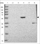 Anti-CHST15 Antibody