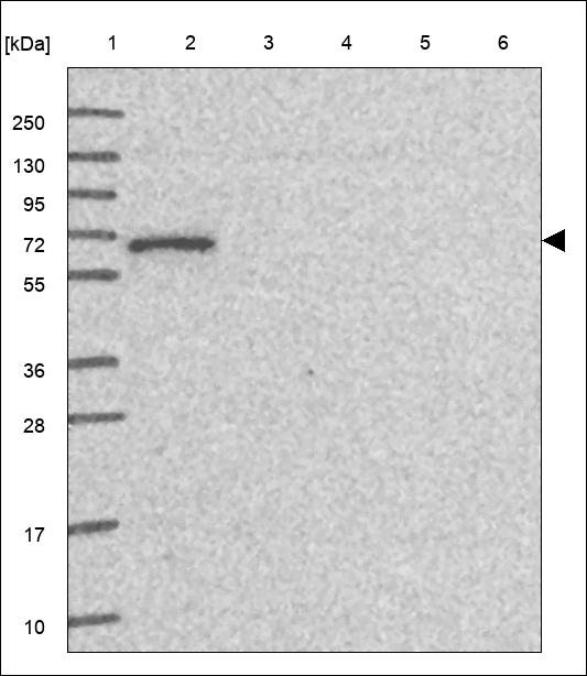 Anti-GPR107 Antibody