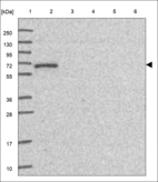Anti-GPR107 Antibody
