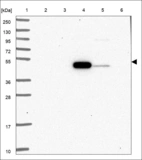 Anti-SYT17 Antibody