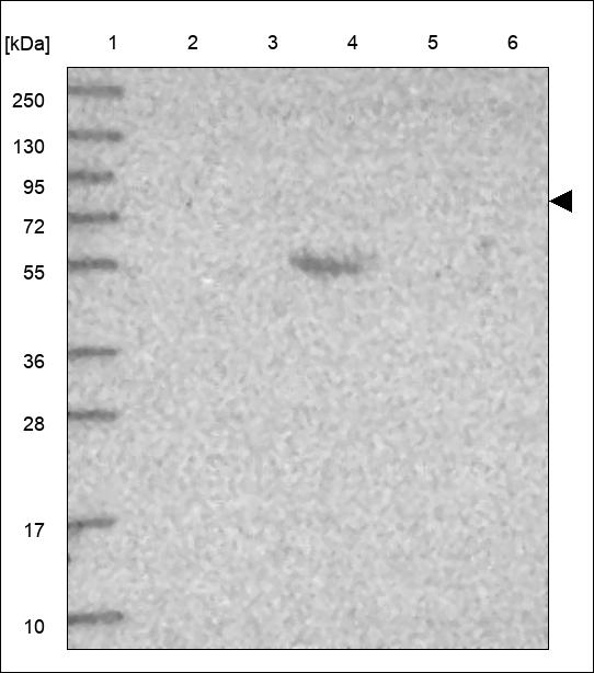 Anti-ADAM11 Antibody