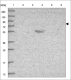 Anti-ADAM11 Antibody