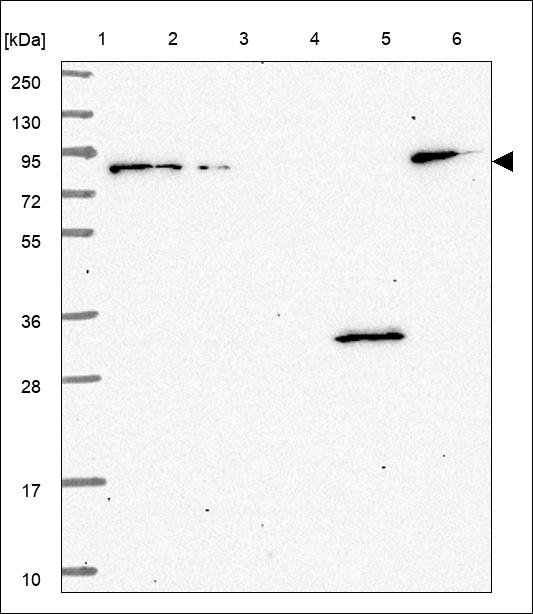 Anti-GTSE1 Antibody