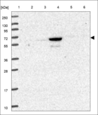 Anti-IRAK1 Antibody
