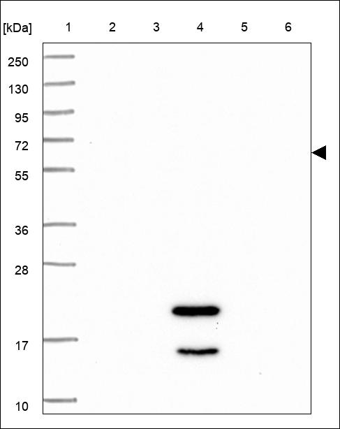 Anti-IRX4 Antibody