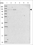 Anti-LRRD1 Antibody
