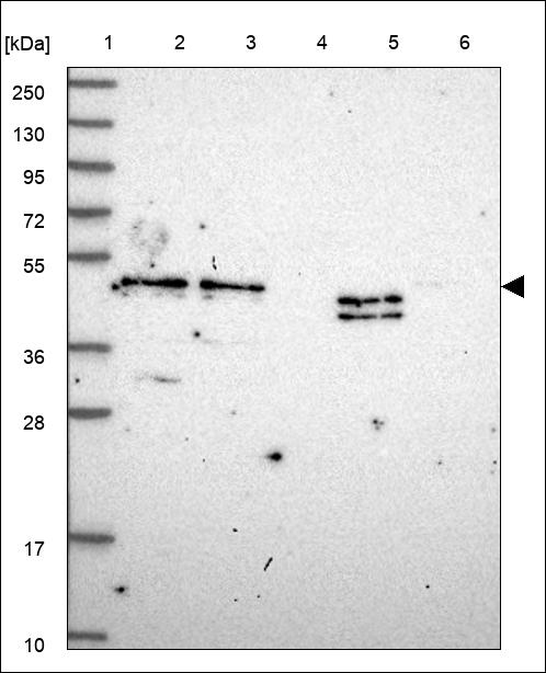 Anti-WDR4 Antibody