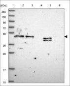 Anti-WDR4 Antibody