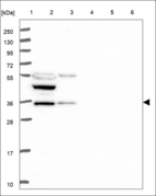 Anti-MRPL1 Antibody