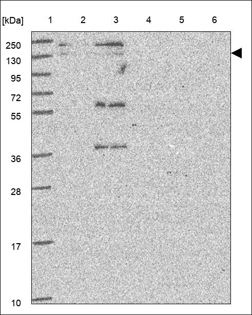 Anti-BLM Antibody