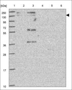 Anti-BLM Antibody