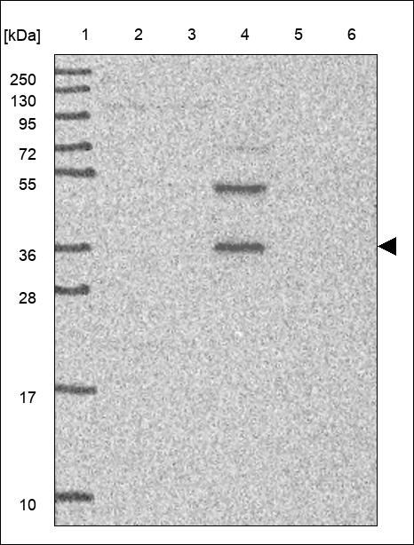 Anti-CA7 Antibody