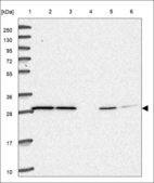 Anti-RAB15 Antibody