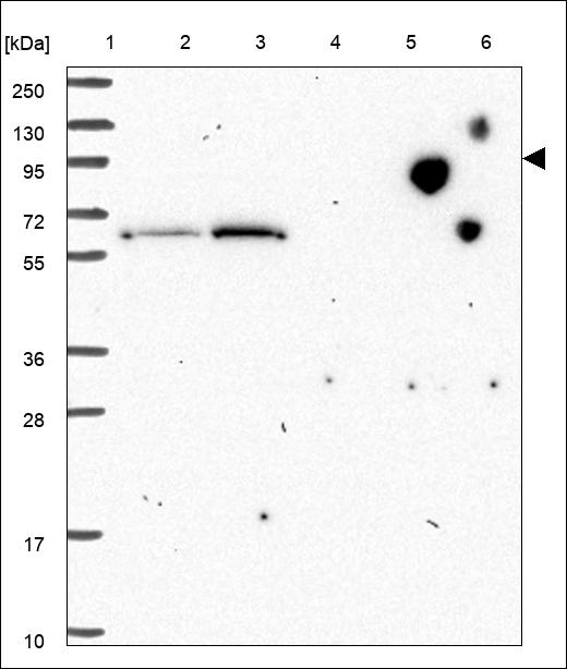 Anti-PTPN4 Antibody
