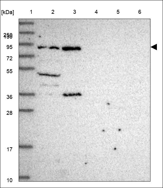 Anti-TDRD3 Antibody