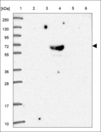 Anti-ABCG2 Antibody