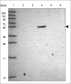 Anti-CCNA1 Antibody