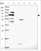 Anti-RASEF Antibody