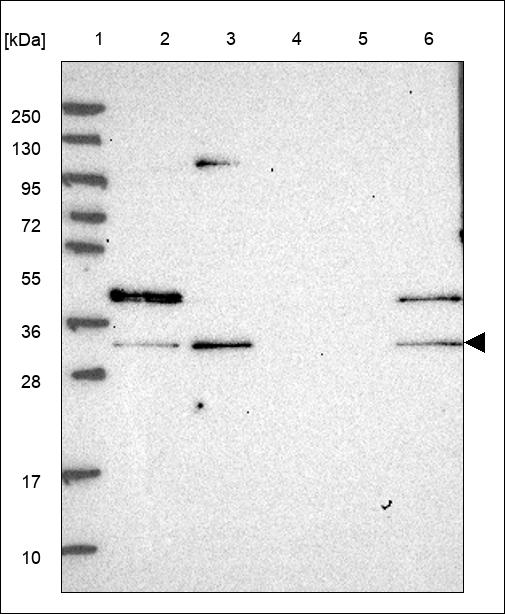 Anti-RNASEH2A Antibody
